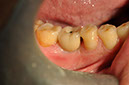 %_tempFileNameImplant%20127c1%