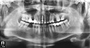 %_tempFileNameImplant%20127d1%