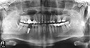 %_tempFileNameImplant%20127d2%