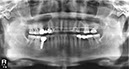 %_tempFileNameImplant%20127d3%