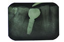 %_tempFileNameImplant%20127d4%