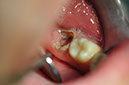 %_tempFileNameImplant%20128a1%