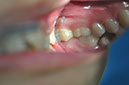 %_tempFileNameImplant%20128a2%