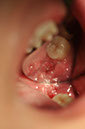 %_tempFileNameImplant%20128a5%