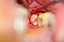 %_tempFileNameImplant%20128a6%
