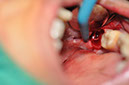 %_tempFileNameImplant%20128a8%