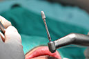 %_tempFileNameImplant%20128a9%