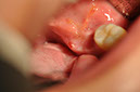 %_tempFileNameImplant%20128b6%