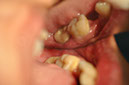 %_tempFileNameImplant%20128c1%