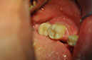 %_tempFileNameImplant%20128c2%