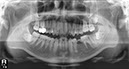 %_tempFileNameImplant%20128d1%