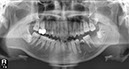 %_tempFileNameImplant%20128d2%