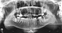 %_tempFileNameImplant%20128d3%