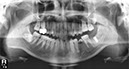 %_tempFileNameImplant%20128d4%