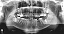 %_tempFileNameImplant%20128d5%