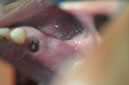 %_tempFileNameImplant%20129a1%