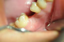 %_tempFileNameImplant%20129a4%