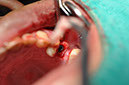 %_tempFileNameImplant%20129b3%