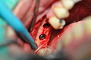 %_tempFileNameImplant%20129b6%