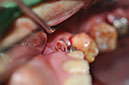 %_tempFileNameImplant%20129c5%
