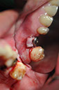 %_tempFileNameImplant%20129c6%