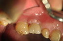 %_tempFileNameImplant%20129c7%