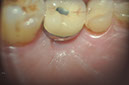 %_tempFileNameImplant%20129c8%