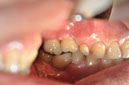 %_tempFileNameImplant%20129c9%