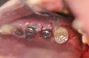 %_tempFileNameImplant%20129d1%