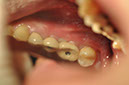 %_tempFileNameImplant%20129d2%