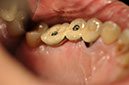 %_tempFileNameImplant%20129d3%
