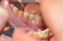 %_tempFileNameImplant%20129d4%