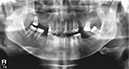 %_tempFileNameImplant%20129e1%