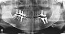 %_tempFileNameImplant%20129e2%