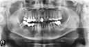 %_tempFileNameImplant%20130a1%