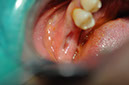 %_tempFileNameImplant%20130a2%