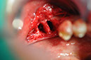 %_tempFileNameImplant%20130a3%