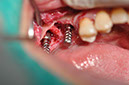 %_tempFileNameImplant%20130a4%