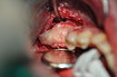 %_tempFileNameImplant%20130a8%