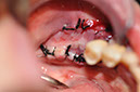 %_tempFileNameImplant%20130a9%