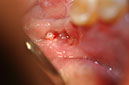 %_tempFileNameImplant%20130b1%