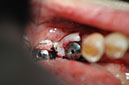 %_tempFileNameImplant%20130b3%