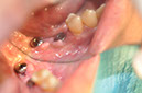 %_tempFileNameImplant%20130b5%