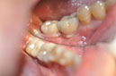 %_tempFileNameImplant%20130b6%