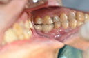 %_tempFileNameImplant%20130b7%