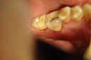 %_tempFileNameImplant%20130b8%