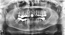 %_tempFileNameImplant%20130c1%