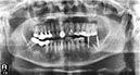 %_tempFileNameImplant%20130c2%