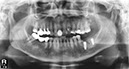 %_tempFileNameImplant%20130c3%