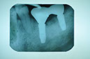 %_tempFileNameImplant%20130c5%